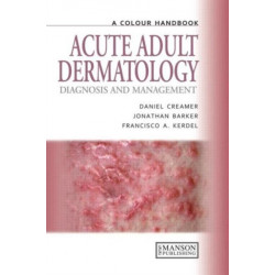 Acute Adult Dermatology: Diagnosis and Management: A Colour Handbook