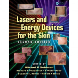 Lasers and Energy Devices for the Skin