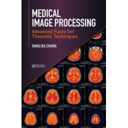 Medical Image Processing: Advanced Fuzzy Set Theoretic Techniques