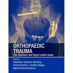 Orthopaedic Trauma: The Stanmore and Royal London Guide