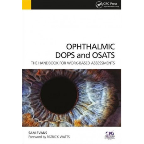 Ophthalmic DOPS and OSATS: The Handbook for Work-Based Assessments