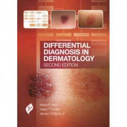 Differential Diagnosis in Dermatology: Second Edition