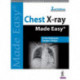 Chest X-ray Made Easy