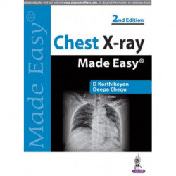 Chest X-ray Made Easy
