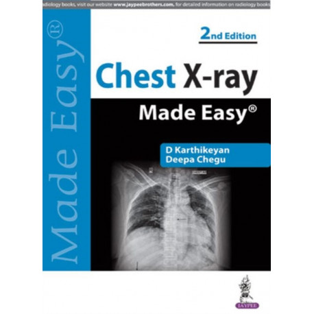 Chest X-ray Made Easy