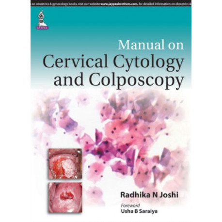 Manual on Cervical Cytology and Colposcopy