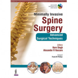 Minimally Invasive Spine Surgery