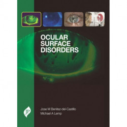 Ocular Surface Disorders