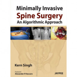 Minimally Invasive Spine Surgery: An Algorithmic Approach