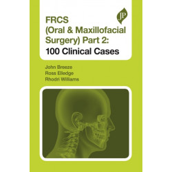 FRCS (Oral & Maxillofacial Surgery) Part 2: 100 Clinical Cases: 100 Clinical Cases
