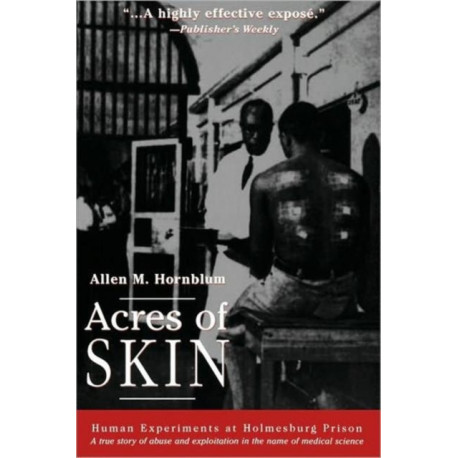 Acres of Skin: Human Experiments at Holmesburg Prison