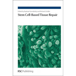 Stem Cell-Based Tissue Repair