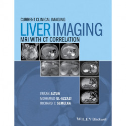 Liver Imaging: MRI with CT Correlation