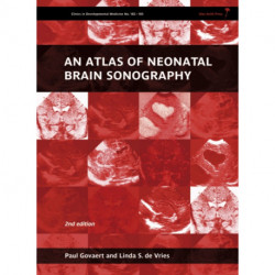 An Atlas of Neonatal Brain Sonography