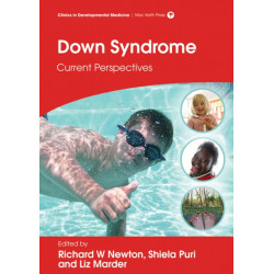 Down Syndrome: Current Perspectives