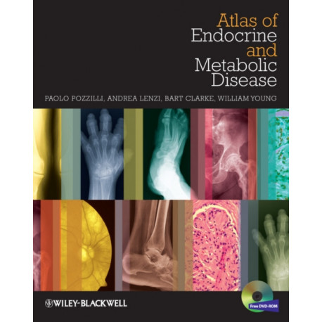 Imaging in Endocrinology