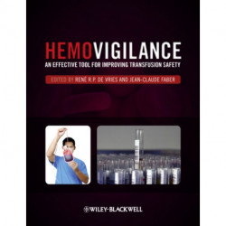 Hemovigilance: An Effective Tool for Improving Transfusion Safety