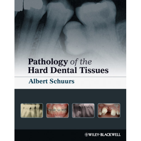 Pathology of the Hard Dental Tissues