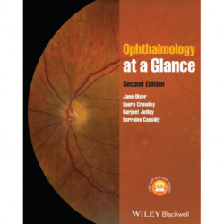 Ophthalmology at a Glance