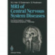 Magnetic Resonance Imaging of Central Nervous System Diseases: Functional Anatomy — Imaging Neurological Symptoms — Pathology