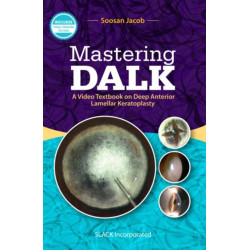 Mastering DALK: A Video Textbook on Deep Anterior Lamellar Keratoplasty
