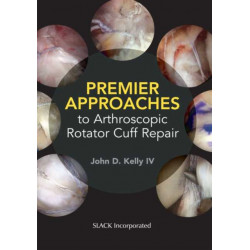 Premier Approaches to Arthroscopic Rotator Cuff Repair