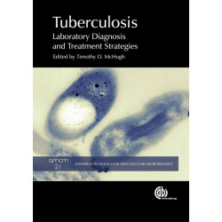 Tuberculosis: Laboratory Diagnosis and Treatment Strategies