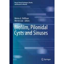 Biofilm, Pilonidal Cysts and Sinuses