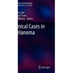 Clinical Cases in Melanoma