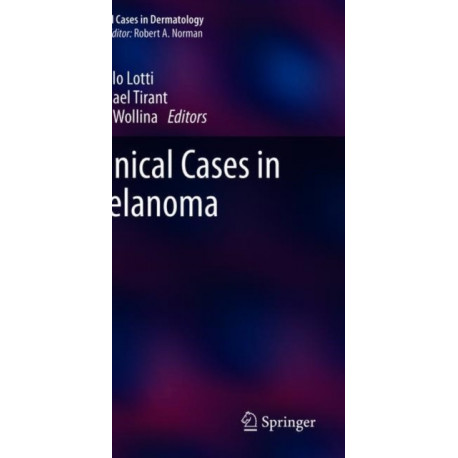Clinical Cases in Melanoma