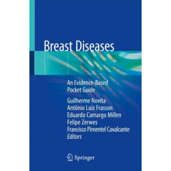 Breast Diseases: An Evidence-Based Pocket Guide