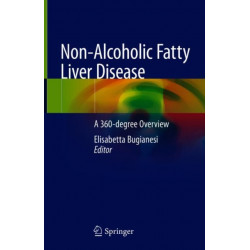 Non-Alcoholic Fatty Liver Disease: A 360-degree Overview
