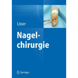 Nagelchirurgie