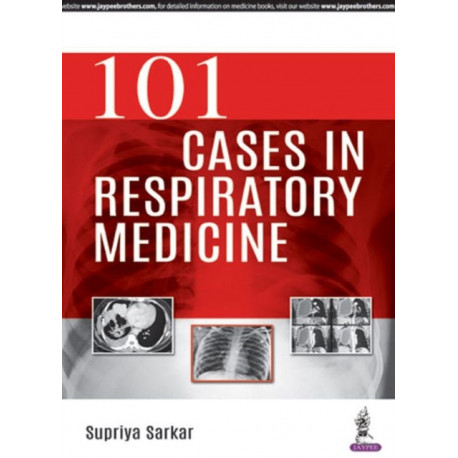 101 Cases in Respiratory Medicine
