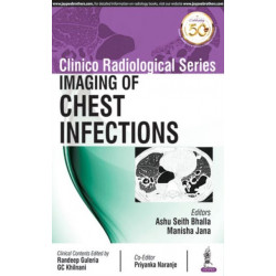 Clinico Radiological Series: Imaging of Chest Infections