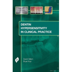 Dentin Hypersensitivity in Clinical Practice