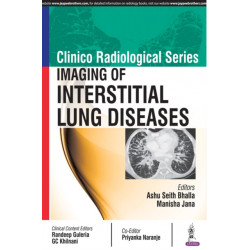 Clinico Radiological Series: Imaging of Interstitial Lung Diseases