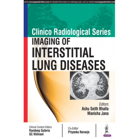 Clinico Radiological Series: Imaging of Interstitial Lung Diseases