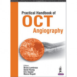 Practical Handbook of OCT Angiography