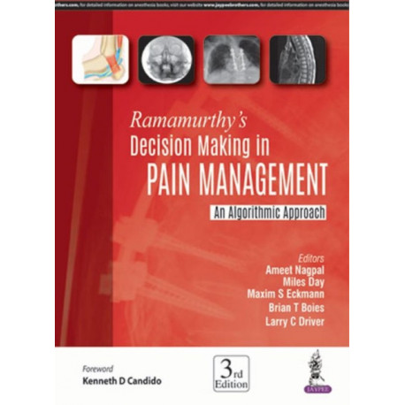 Ramamurthy's Decision Making in Pain Management: An Algorithmic Approach