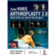 Total Knee Arthroplasty 2.0: What CAS can add to the Surgery