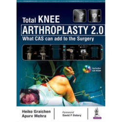 Total Knee Arthroplasty 2.0: What CAS can add to the Surgery