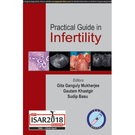 Practical Guide in Infertility