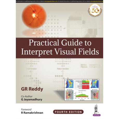 Practical Guide to Interpret Visual Fields