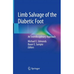 Limb Salvage of the Diabetic Foot: An Interdisciplinary Approach