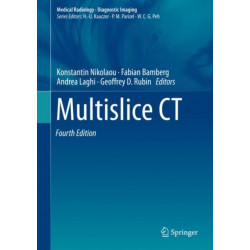 Multislice CT
