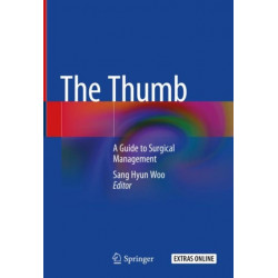The Thumb: A Guide to Surgical Management