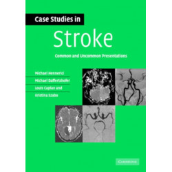 Case Studies in Stroke: Common and Uncommon Presentations