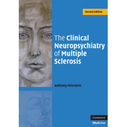 The Clinical Neuropsychiatry of Multiple Sclerosis
