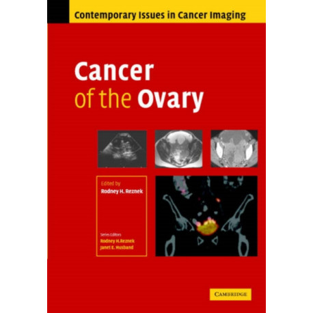 Cancer of the Ovary